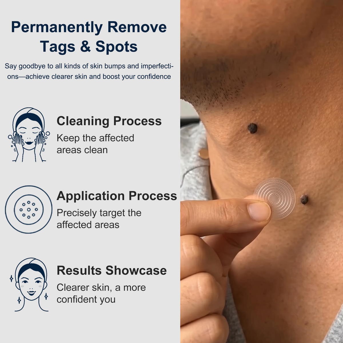 【 💎Last Day Promotion 70% OFF💎】🇺🇸𝐇𝐞𝒂𝒍𝗿𝗶𝙯𝙚®2-in-1 Microneedle & Hydrocolloid Patch| Removes Raised Moles, Acne, Flat Warts & Skin Tags | Helps Improve Wrinkles, Scars & Blemishes | Invisible Patches for Face & Body