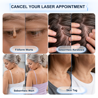 【 💎Last Day Promotion 70% OFF💎】🇺🇸𝐇𝐞𝒂𝒍𝗿𝗶𝙯𝙚®2-in-1 Microneedle & Hydrocolloid Patch| Removes Raised Moles, Acne, Flat Warts & Skin Tags | Helps Improve Wrinkles, Scars & Blemishes | Invisible Patches for Face & Body